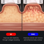 AGE-R Contour Body Shot